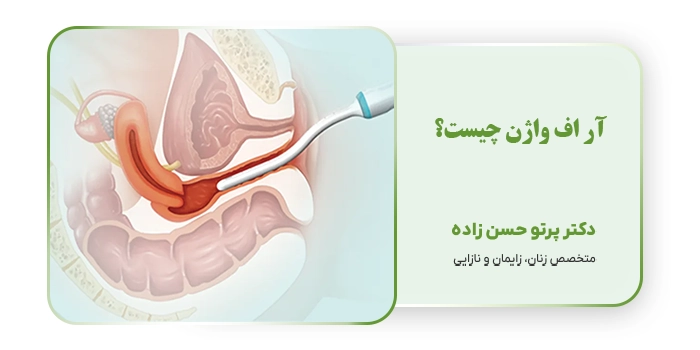 آر اف واژن چیست؟
