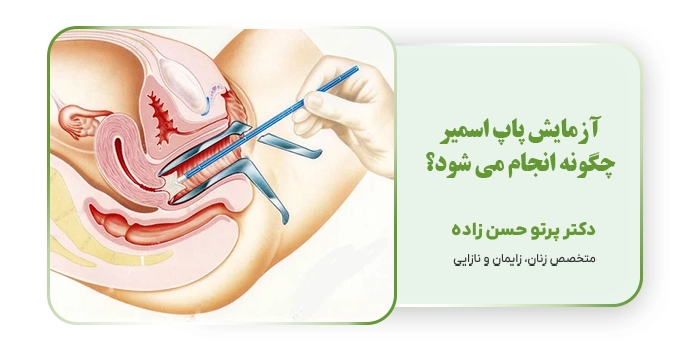 آزمایش پاپ اسمیر چگونه انجام می شود؟
