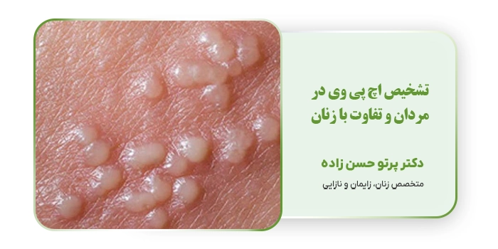 تشخیص اچ پی وی در مردان و تفاوت با زنان