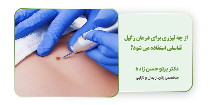 از چه لیزری برای درمان زگیل تناسلی استفاده می شود؟