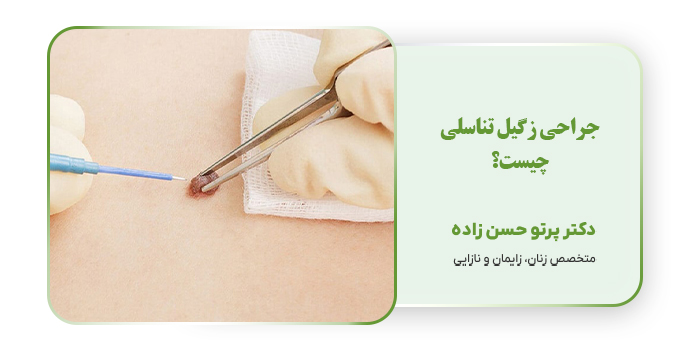 جراحی زگیل تناسلی چیست؟