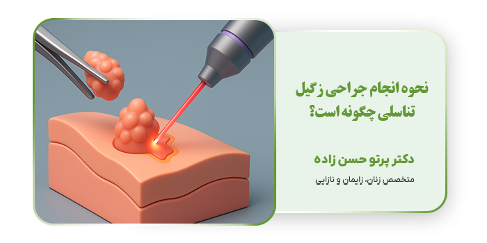 نحوه انجام جراحی زگیل تناسلی چگونه است؟
