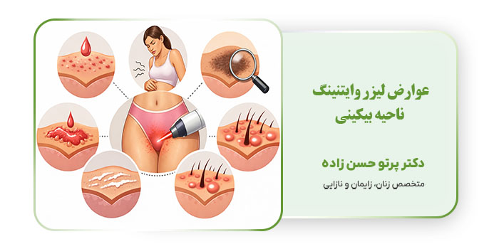 عوارض لیزر وایتنینگ ناحیه بیکینی